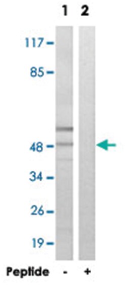 ARRDC1 Rabbit anti-Human, Mouse, Rat, Polyclonal Antibody, Abnova 100 &mu;g | Buy Online | Abnova Corporation | Fisher Scientific