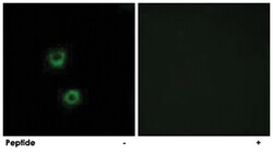 TMEM30C, Rabbit, Polyclonal Antibody, Abnova 100 &mu;g | Buy Online | Abnova | Fisher Scientific