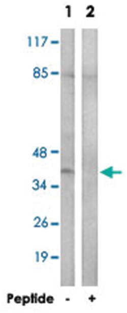 CCRL1 Rabbit anti-Human, Mouse, Polyclonal Antibody, Abnova 100&mu;g; Unlabeled:Antibodies,