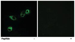 CCRL1 Rabbit anti-Human, Mouse, Polyclonal Antibody, Abnova 100&mu;g; Unlabeled:Antibodies,