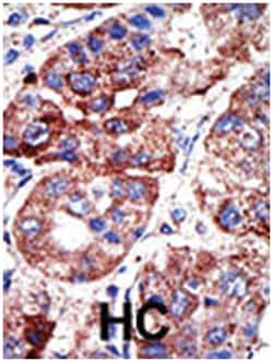 SQSTM1 Rabbit anti-Human, Polyclonal Antibody, Abnova 400&mu;L; Unlabeled:Antibodies,