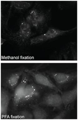 SQSTM1 Rabbit anti-Human, Polyclonal Antibody, Abnova 400&mu;L; Unlabeled:Antibodies,