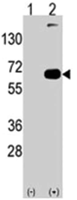 SQSTM1 Rabbit anti-Human, Polyclonal Antibody, Abnova 400&mu;L; Unlabeled:Antibodies,