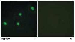 CDCA4, Rabbit, Polyclonal Antibody, Abnova 100&mu;g; Unlabeled:Antibodies,