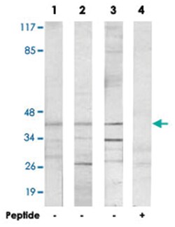 CMKLR1 Rabbit anti-Human, Mouse, Rat, Polyclonal Antibody, Abnova 100&mu;g;