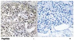 CNTD2, Rabbit, Polyclonal Antibody, Abnova 100&mu;g; Unlabeled:Antibodies,