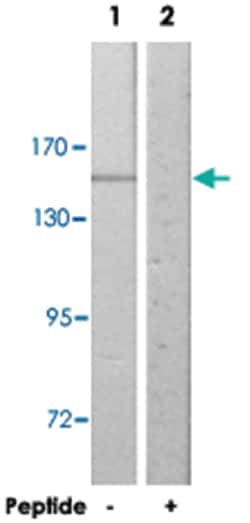COL4A2 Rabbit anti-Human, Mouse, Polyclonal Antibody, Abnova 100 &mu;g | Buy Online | Abnova | Fisher Scientific