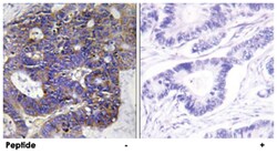 COL4A2 Rabbit anti-Human, Mouse, Polyclonal Antibody, Abnova 100 &mu;g | Buy Online | Abnova | Fisher Scientific