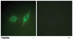 COL4A2 Rabbit anti-Human, Mouse, Polyclonal Antibody, Abnova 100 &mu;g | Buy Online | Abnova | Fisher Scientific