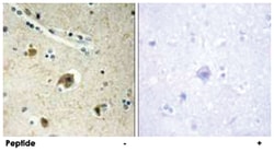 COL4A4, Rabbit, Polyclonal Antibody, Abnova 100&mu;g; Unlabeled:Antibodies,
