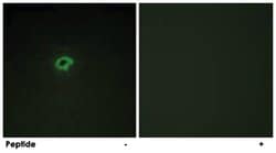 COL4A4, Rabbit, Polyclonal Antibody, Abnova 100&mu;g; Unlabeled:Antibodies,