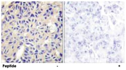 COL5A2, Rabbit, Polyclonal Antibody, Abnova 100&mu;g; Unlabeled:Antibodies,