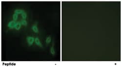 COL5A2, Rabbit, Polyclonal Antibody, Abnova 100&mu;g; Unlabeled:Antibodies,