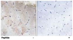 COL12A1, Rabbit, Polyclonal Antibody, Abnova 100&mu;g; Unlabeled:Antibodies,