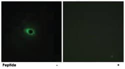 COL12A1, Rabbit, Polyclonal Antibody, Abnova 100&mu;g; Unlabeled:Antibodies,