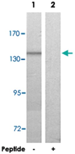 COL20A1, Rabbit, Polyclonal Antibody, Abnova 100&mu;g; Unlabeled:Antibodies,
