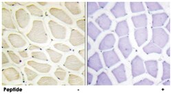 COL20A1, Rabbit, Polyclonal Antibody, Abnova 100&mu;g; Unlabeled:Antibodies,