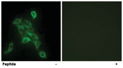 COX6C, Rabbit, Polyclonal Antibody, Abnova 100&mu;g; Unlabeled:Antibodies,