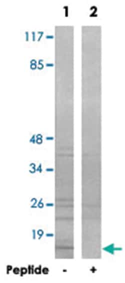 COX7A2P2, Rabbit, Polyclonal Antibody, Abnova 100&mu;g; Unlabeled:Antibodies,