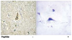 CYP26C1, Rabbit, Polyclonal Antibody, Abnova 100&mu;g; Unlabeled:Antibodies,