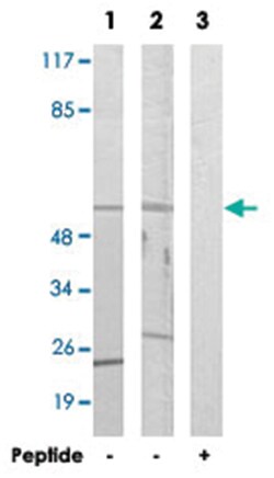 CYP39A1, Rabbit, Polyclonal Antibody, Abnova 100&mu;g; Unlabeled:Antibodies,