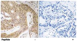 DAP Rabbit anti-Human, Mouse, Polyclonal Antibody, Abnova 100&mu;g; Unlabeled:Antibodies,