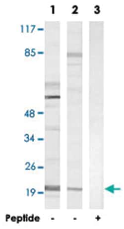 FGF22 Rabbit anti-Human, Mouse, Rat, Polyclonal Antibody, Abnova 100&mu;g;