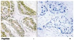 BAX Rabbit anti-Human, Mouse, Rat, Polyclonal Antibody, Abnova 100&mu;g;