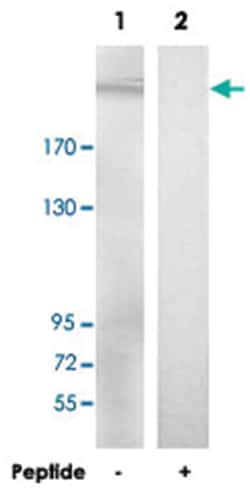 LAMB2 Rabbit anti-Human, Mouse, Rat, Polyclonal Antibody, Abnova 100&mu;g;