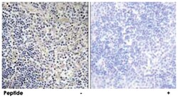TP53AIP1, Rabbit, Polyclonal Antibody, Abnova 100&mu;g; Unlabeled:Antibodies,