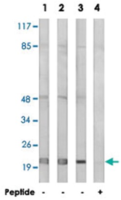 MRPL32, Rabbit, Polyclonal Antibody, Abnova 100&mu;g; Unlabeled:Antibodies,