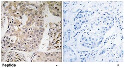 MRPL41 Rabbit anti-Human, Mouse, Rat, Polyclonal Antibody, Abnova 100&mu;g;