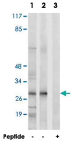 MRPL47 Rabbit anti-Human, Polyclonal Antibody, Abnova 100&mu;g; Unlabeled:Antibodies,