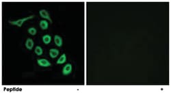 RPS12 Rabbit anti-Human, Mouse, Rat, Polyclonal Antibody, Abnova 100 &mu;g | Buy Online | Abnova Corporation | Fisher Scientific