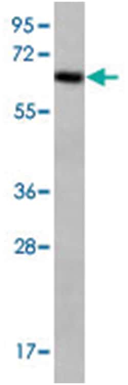 TPTE Rabbit anti-Human, Polyclonal Antibody, Abnova 400&mu;L; Unlabeled:Antibodies,
