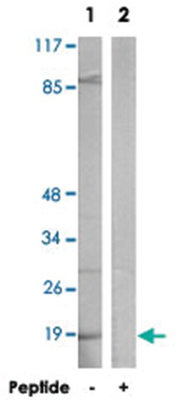 RPS27L, Rabbit, Polyclonal Antibody, Abnova 100&mu;g; Unlabeled:Antibodies,