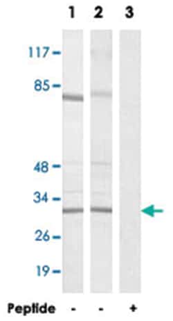 RPS4X, Rabbit, Polyclonal Antibody, Abnova 100 &mu;g | Buy Online | Abnova Corporation | Fisher Scientific