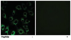 RPS4X, Rabbit, Polyclonal Antibody, Abnova 100 &mu;g | Buy Online | Abnova Corporation | Fisher Scientific