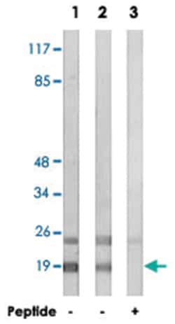 RPL12 Rabbit anti-Human, Mouse, Polyclonal Antibody, Abnova 100 &mu;g | Buy Online | Abnova Corporation | Fisher Scientific