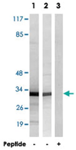 RPL7, Rabbit, Polyclonal Antibody, Abnova 100 &mu;g | Buy Online | Abnova | Fisher Scientific