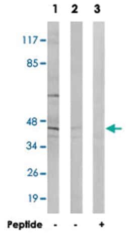 ABHD8 Rabbit anti-Human, Mouse, Polyclonal Antibody, Abnova 100 &mu;g | Buy Online | Abnova | Fisher Scientific