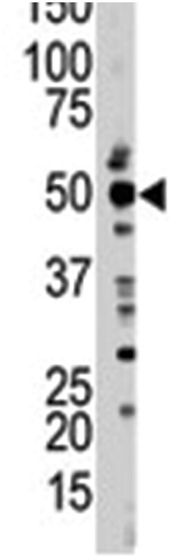 TSG101 Rabbit anti-Human, Mouse, Polyclonal Antibody, Abnova 400&mu;L;
