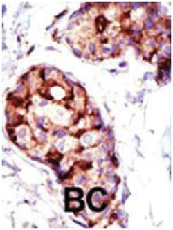 TSG101 Rabbit anti-Human, Mouse, Polyclonal Antibody, Abnova 400&mu;L;