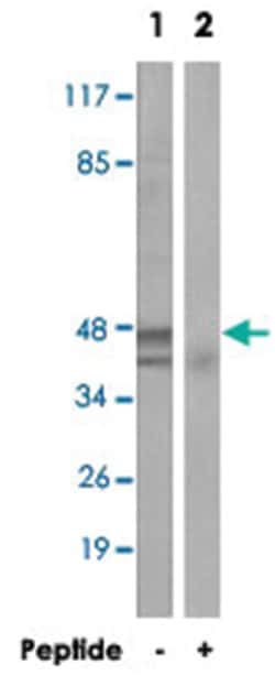 ACOT1, Rabbit, Polyclonal Antibody, Abnova 100&mu;g; Unlabeled:Antibodies,