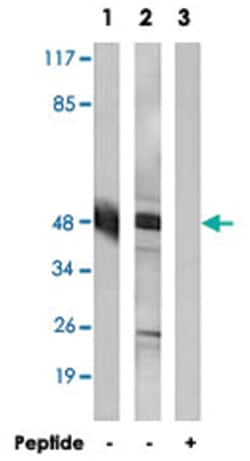 ACOT4 Rabbit anti-Human, Polyclonal Antibody, Abnova 100&mu;g; Unlabeled:Antibodies,