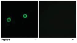 ACOT4 Rabbit anti-Human, Polyclonal Antibody, Abnova 100&mu;g; Unlabeled:Antibodies,