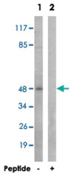 TMEM237, Rabbit, Polyclonal Antibody, Abnova 100&mu;g; Unlabeled:Antibodies,