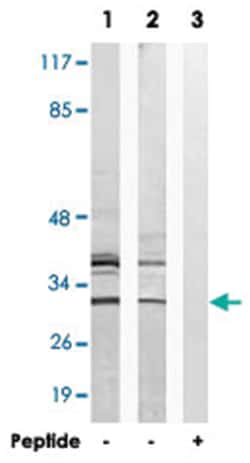 AIG1 Rabbit anti-Human, Polyclonal Antibody, Abnova 100 &mu;g | Buy Online | Abnova Corporation | Fisher Scientific