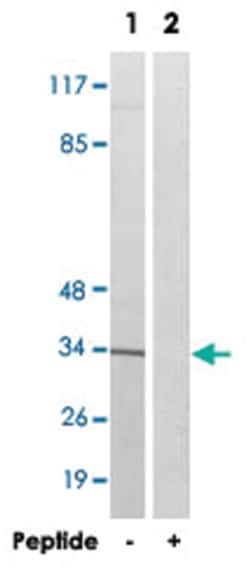 AQP12A, Rabbit, Polyclonal Antibody, Abnova 100&mu;g; Unlabeled:Antibodies,