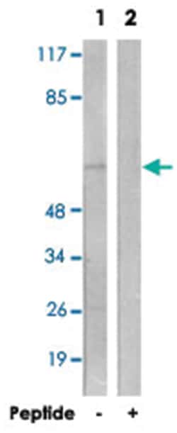 ARSI Rabbit anti-Human, Polyclonal Antibody, Abnova 100&mu;g; Unlabeled:Antibodies,